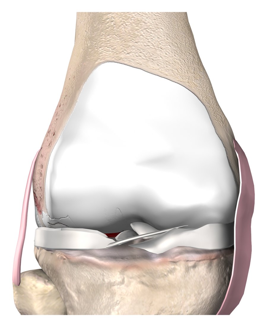 3D illustration of a healthy knee joint with smooth, intact cartilage surfaces