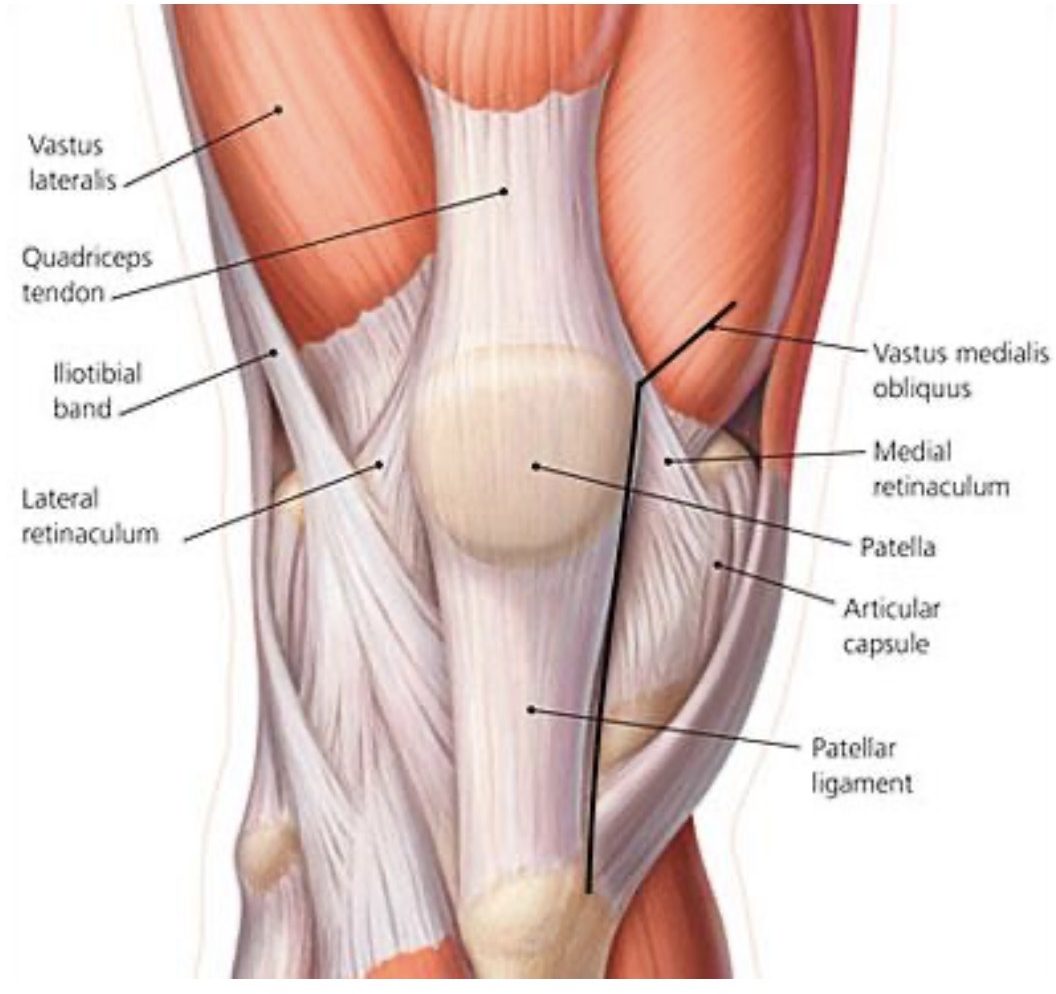 Labeled anatomical diagram of the front of the knee showing the quadriceps tendon, patella, patellar ligament, and vastus medialis obliquus, with a black line marking the midvastus incision path passing through the VMO muscle rather than the quadriceps tendon.